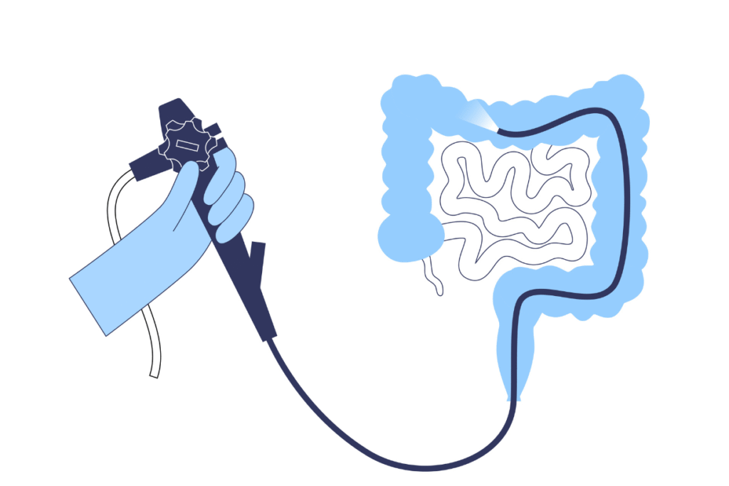 What is Endoscopy and its Types
