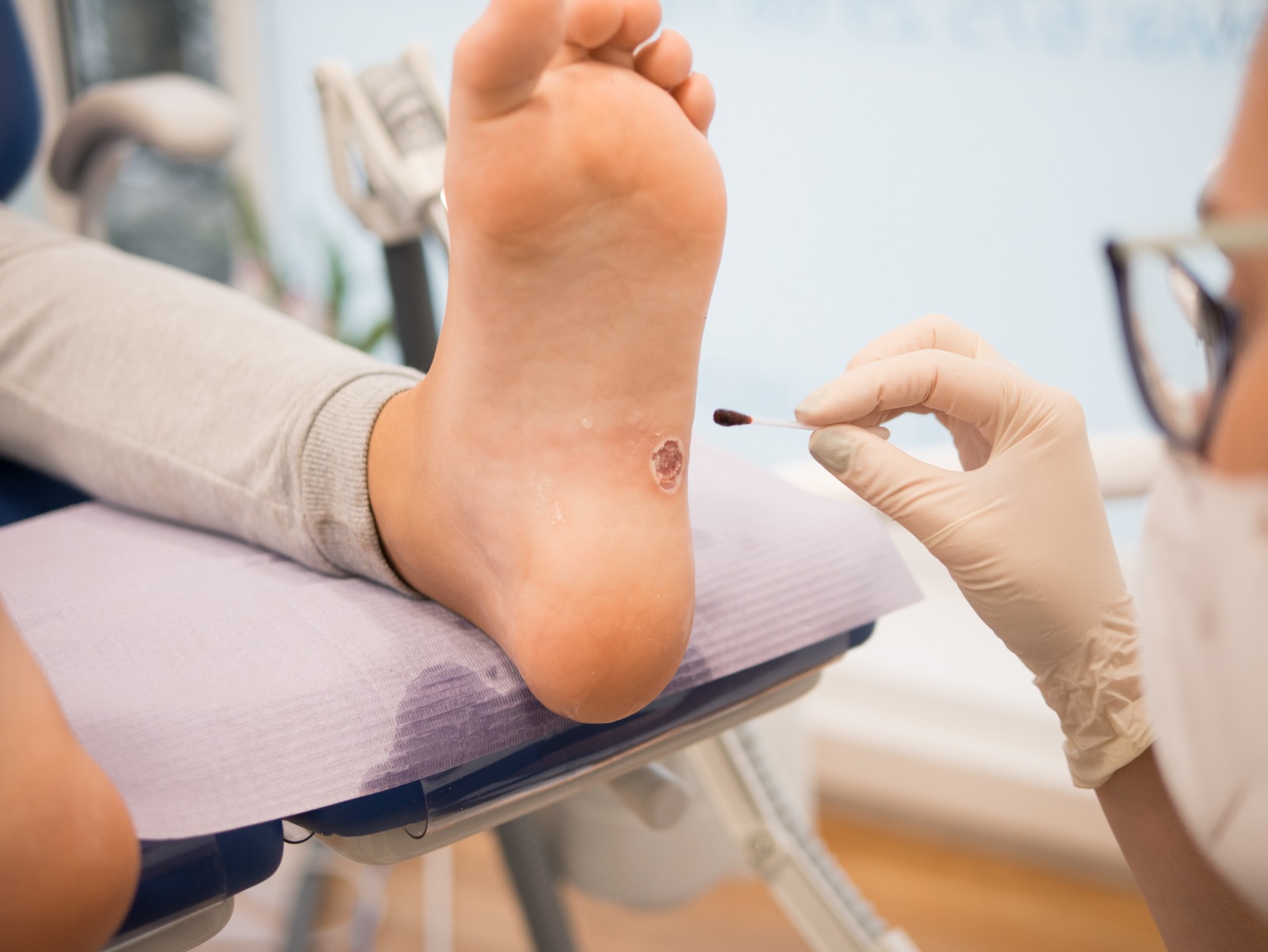 Diabetic Foot Care in Haveri